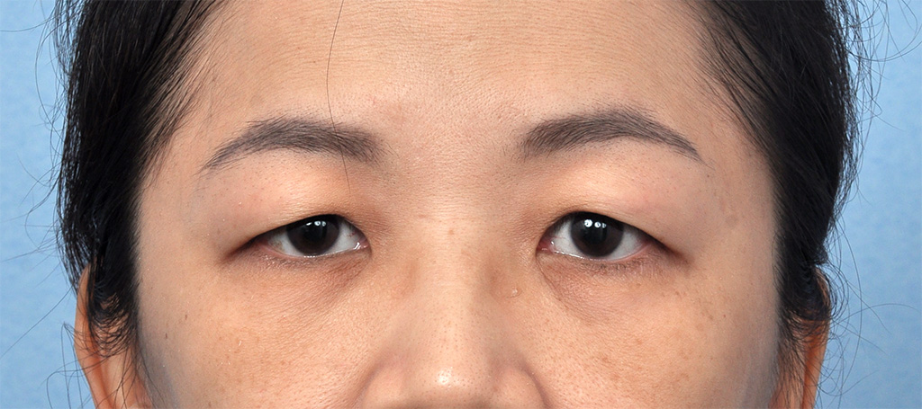 CCW 1