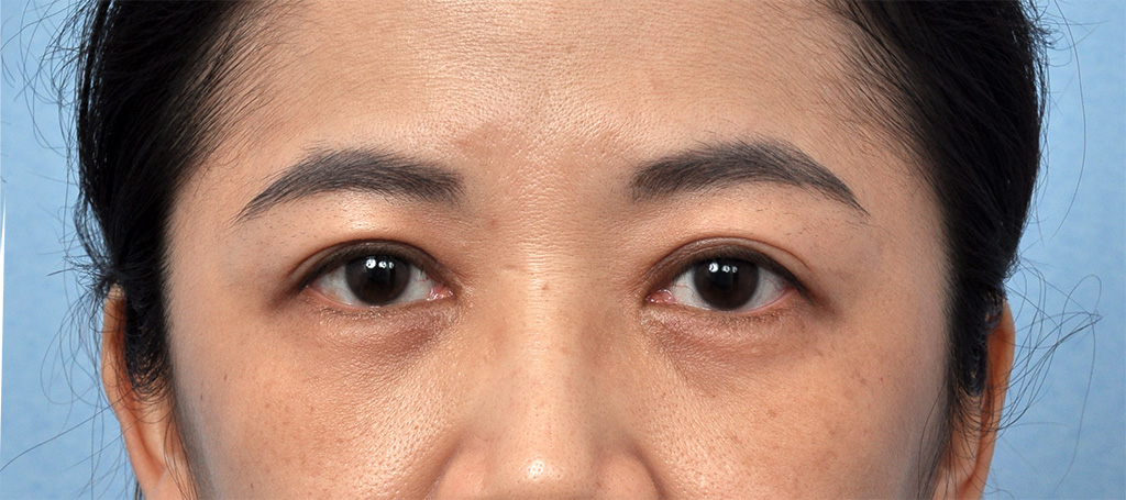 CCW 2