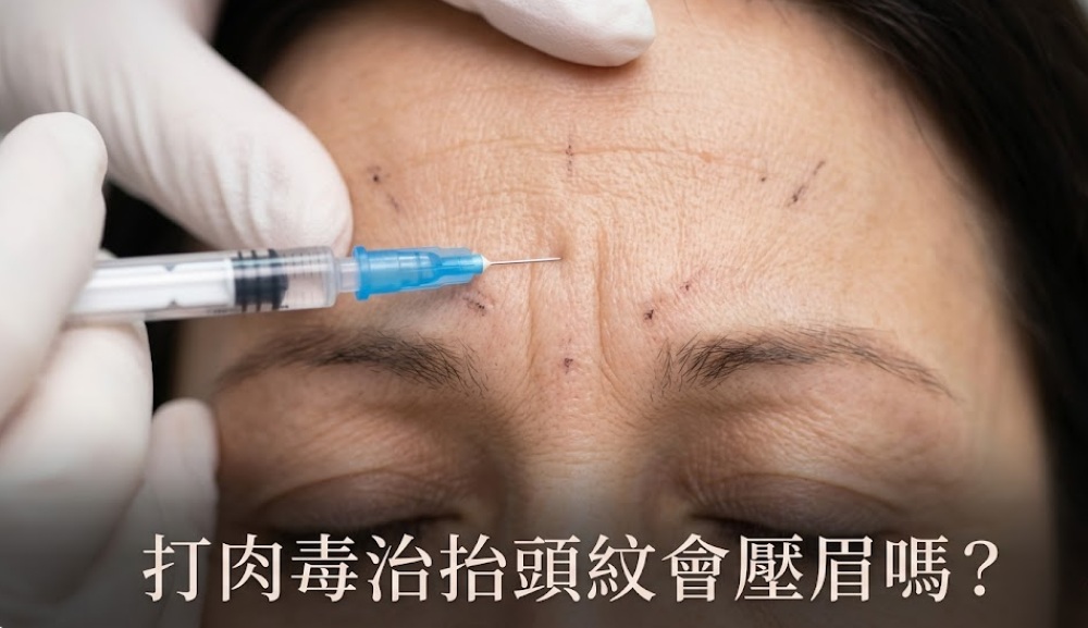打肉毒會眉壓眼嗎?